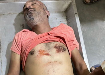 ई रिक्शा चालक से कार सवार ने की मारपीट, ई रिक्शा चालक की मौत