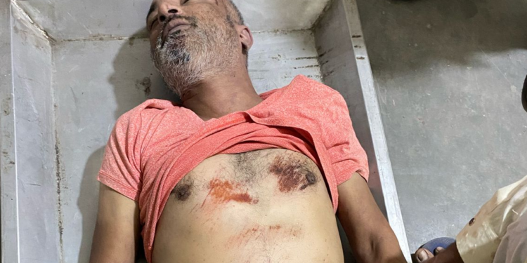 ई रिक्शा चालक से कार सवार ने की मारपीट, ई रिक्शा चालक की मौत